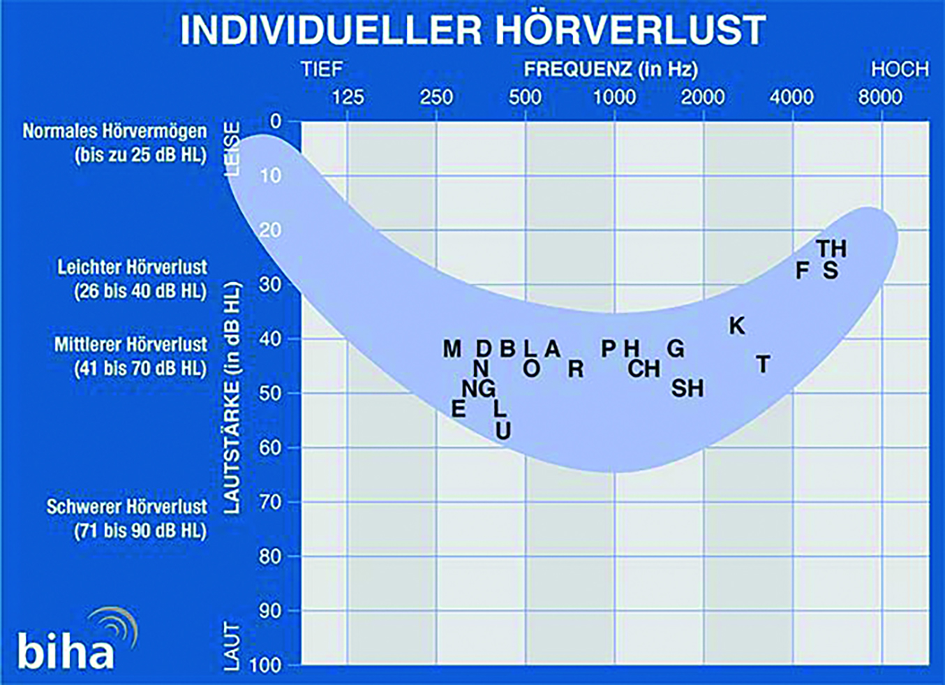 Der Brillenmacher Frau freut sich über Ihre neuen Hörsysteme.jpg